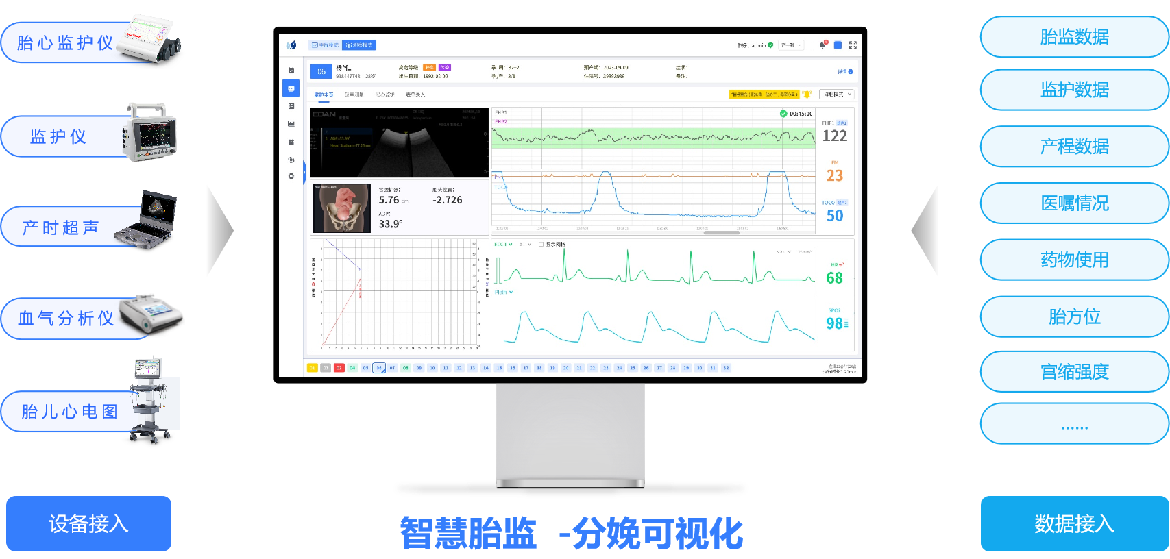 分娩可视化.png